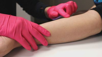 Inyecciones de bienestar: así es la terapia intravenosa que refuerza el sistema inmunitario