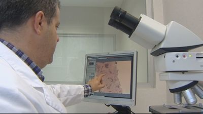La sanidad madrileña incorpora un potente medicamento para luchar contra el cáncer de mama