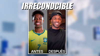 Vinícius revoluciona las redes por una operación estética