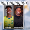 Vinícius revoluciona las redes por una operación estética