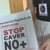 Sobrevivir con un cavernoma hereditario