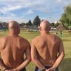 Investigadores madrileños dan con una clave de la alopecia: la falta de una proteína