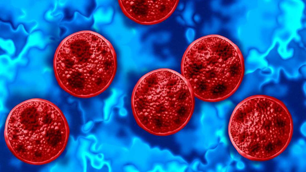 Ciclosporiasis