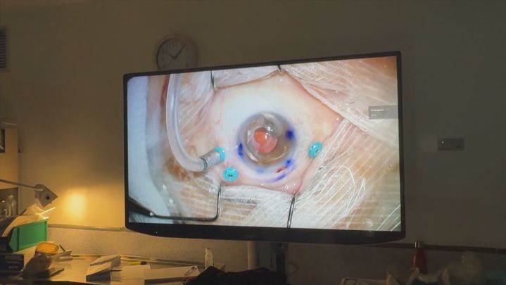 Pantalla de una cirujía ocular / Telemadrid