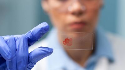 Un paso más para prevenir el cáncer de la sangre: descubren cómo las células precancerosas aceleran el envejecimiento de la médula ósea