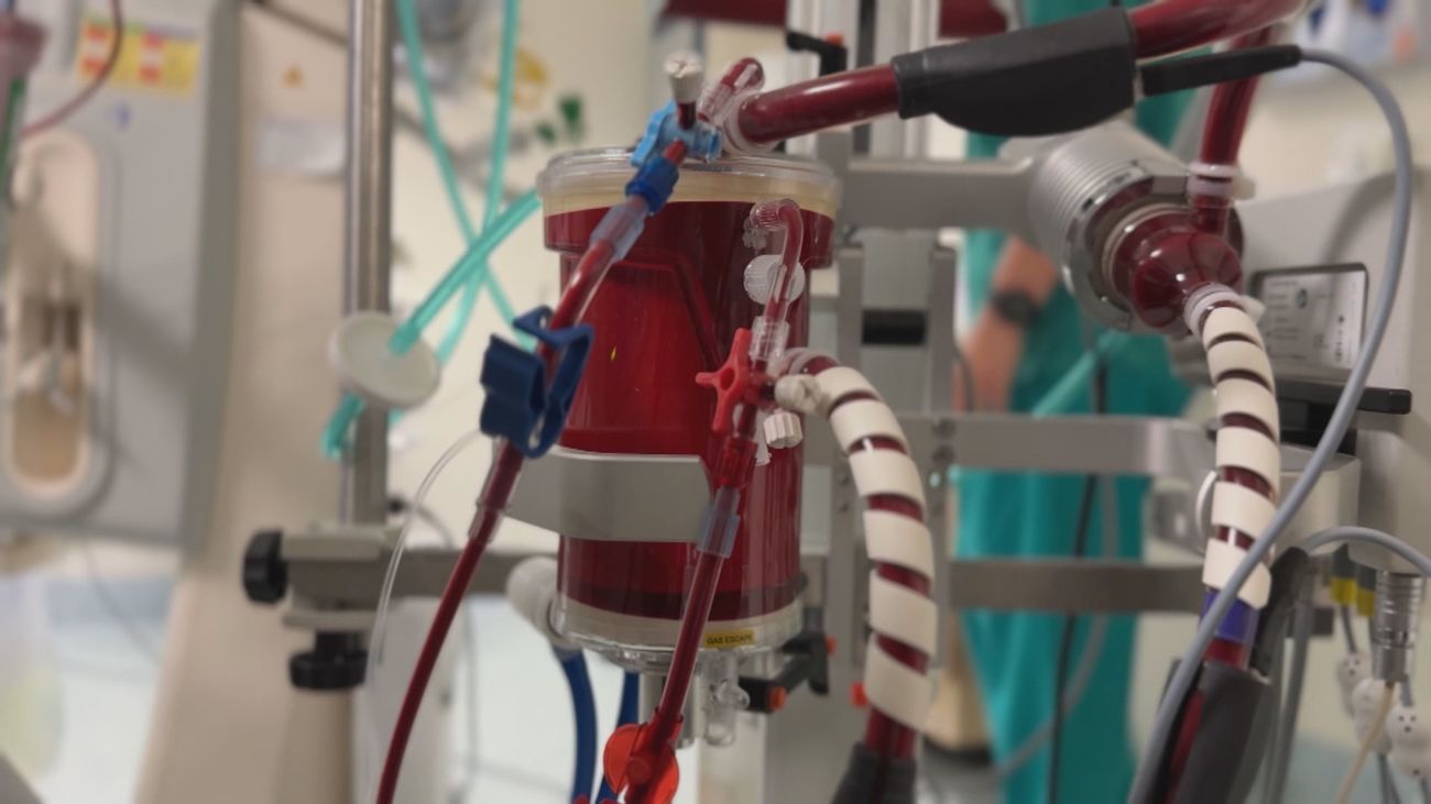 La Paz utiliza por primera vez en el mundo una innovadora tecnología para dar soporte al corazón y los pulmones de pacientes críticos