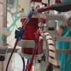 La Paz utiliza por primera vez en el mundo una innovadora tecnología para dar soporte al corazón y los pulmones de pacientes críticos
