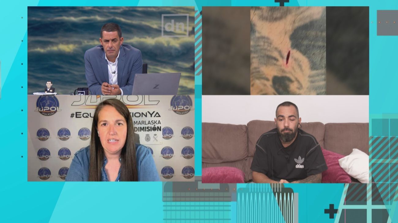 Un vecino de Ceuta relata el apuñalamiento que sufrió durante un intento de robo en La Almadraba