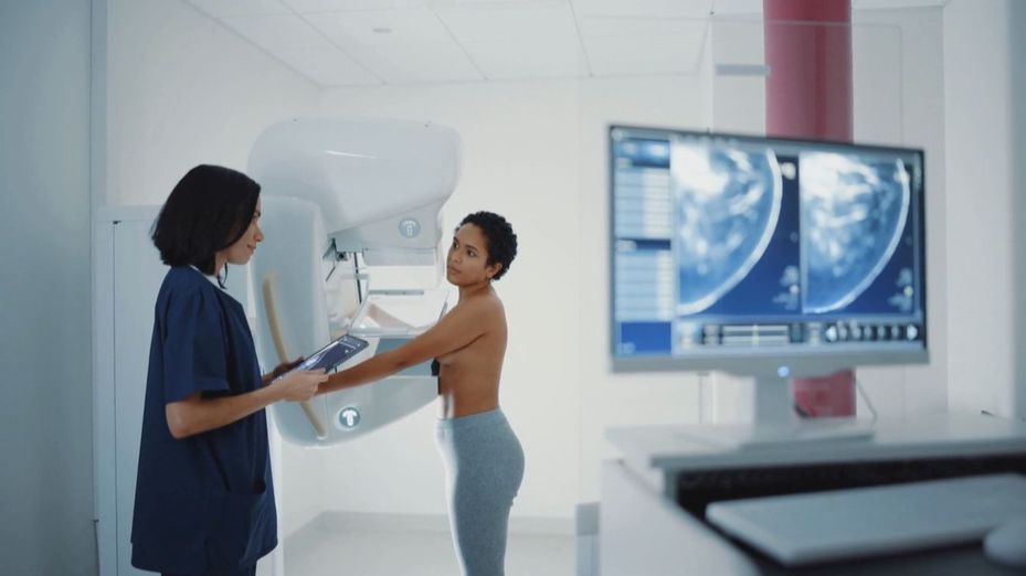 Día Mundial del Cáncer de Mama: aprende la importancia de la prevención